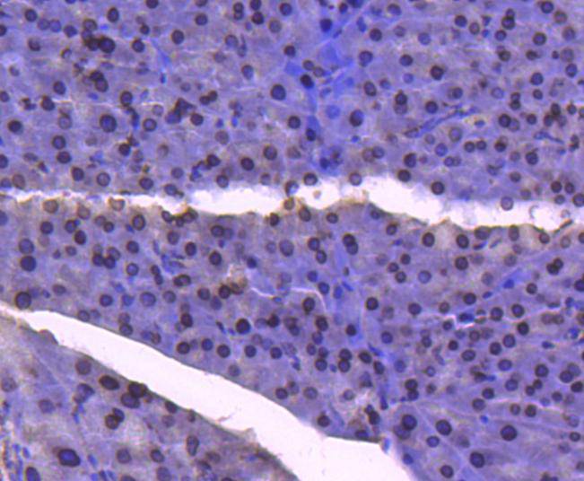 E2F1 Rabbit mAb