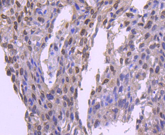 E2F1 Rabbit mAb