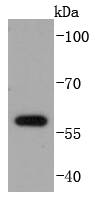 E2F1 Rabbit mAb