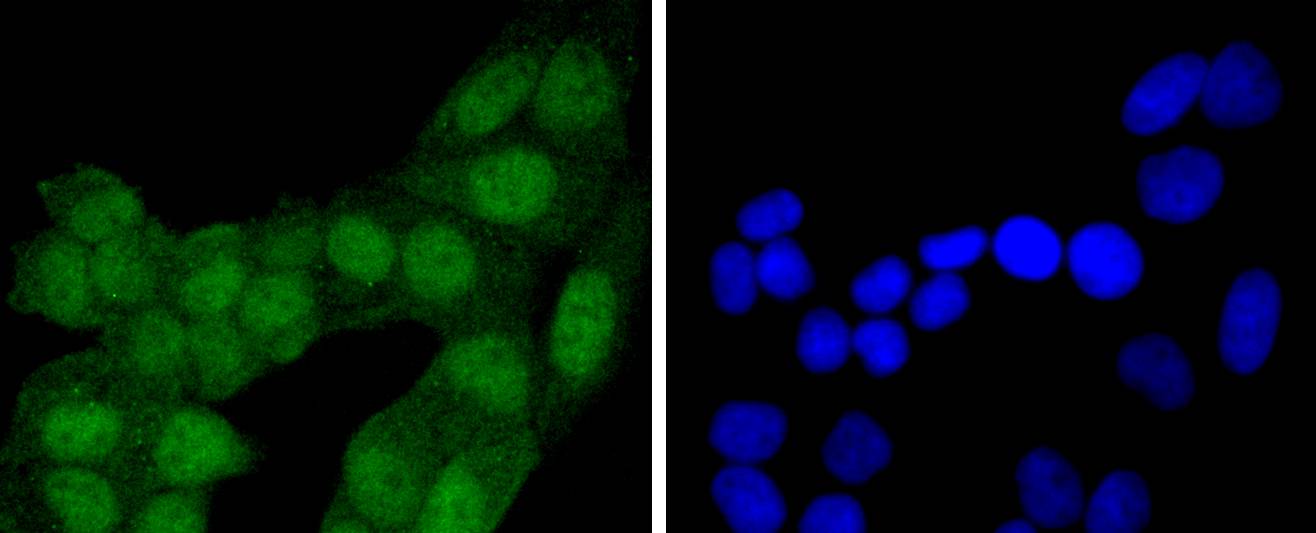 eIF4EBP1 Rabbit mAb