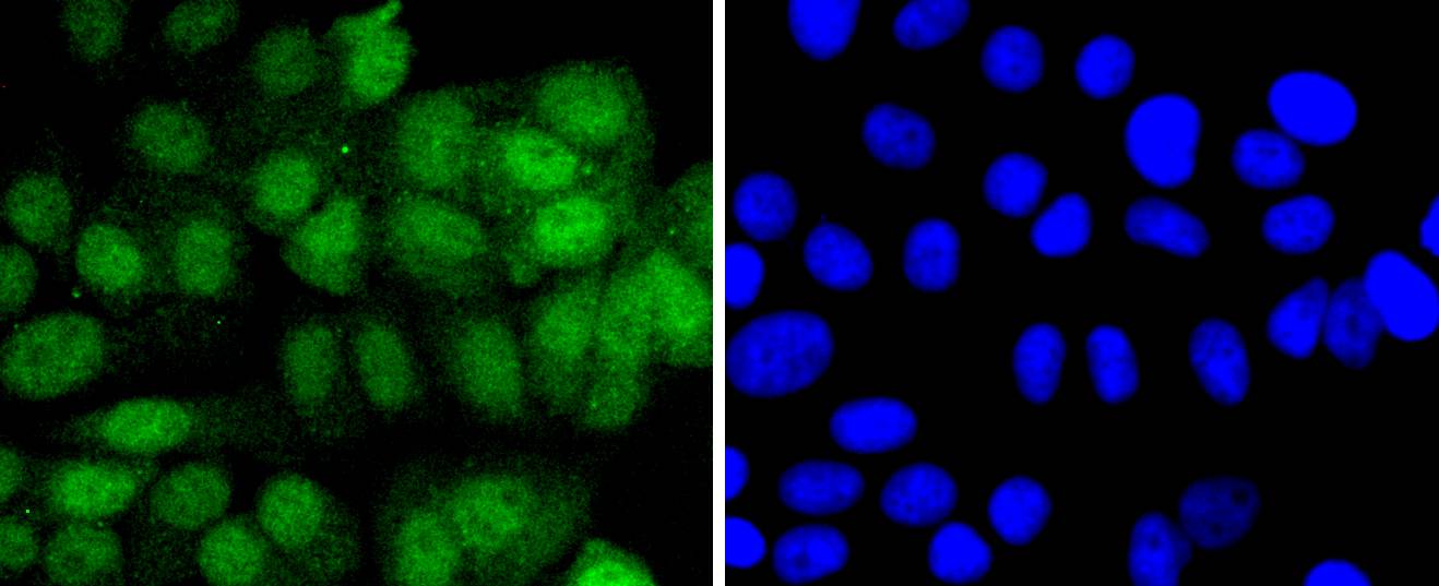 eIF4EBP1 Rabbit mAb