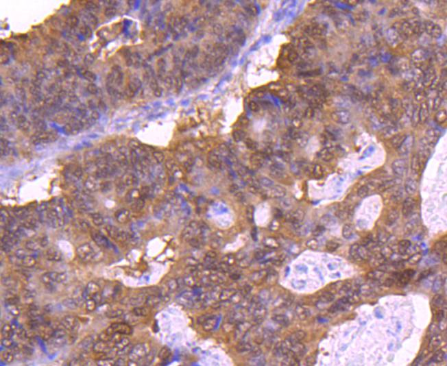 eIF4EBP1 Rabbit mAb