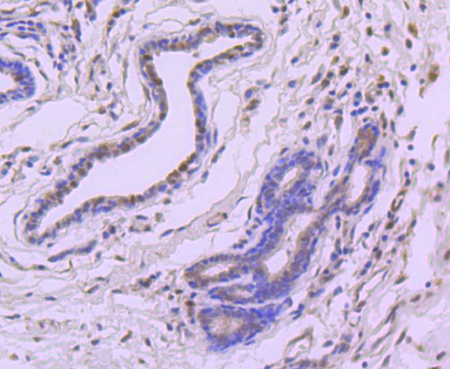 eIF4EBP1 Rabbit mAb