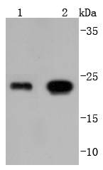 Glutathione Peroxidase 1 Rabbit mAb