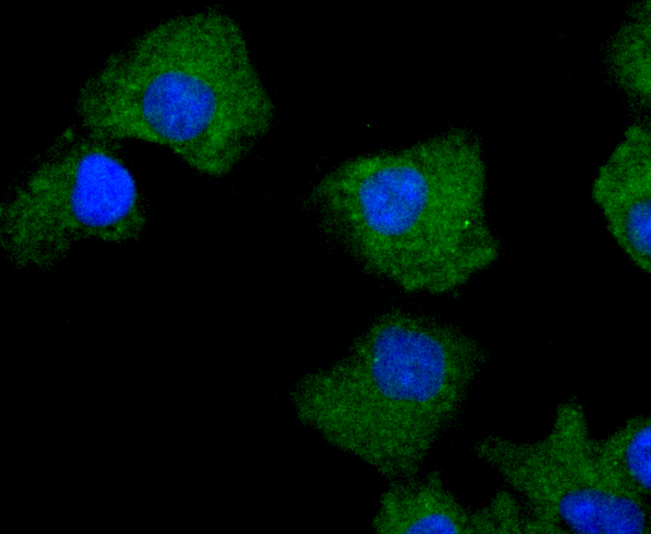 PKC delta Rabbit mAb