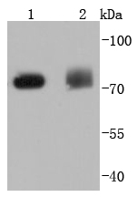 PKC delta Rabbit mAb