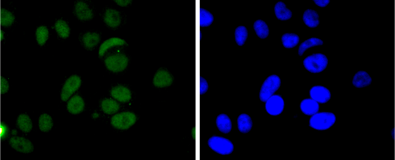 FUS/TLS Rabbit mAb