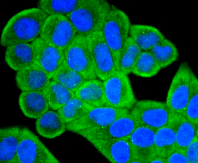 IGF2 Rabbit mAb