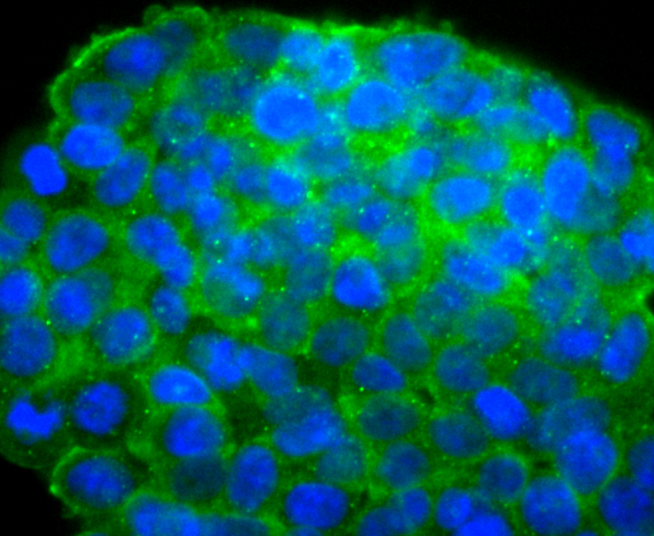 IGF2 Rabbit mAb