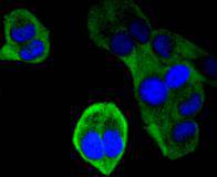 Ubiquitin D Rabbit mAb