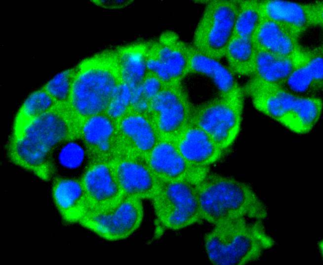 Ubiquitin D Rabbit mAb