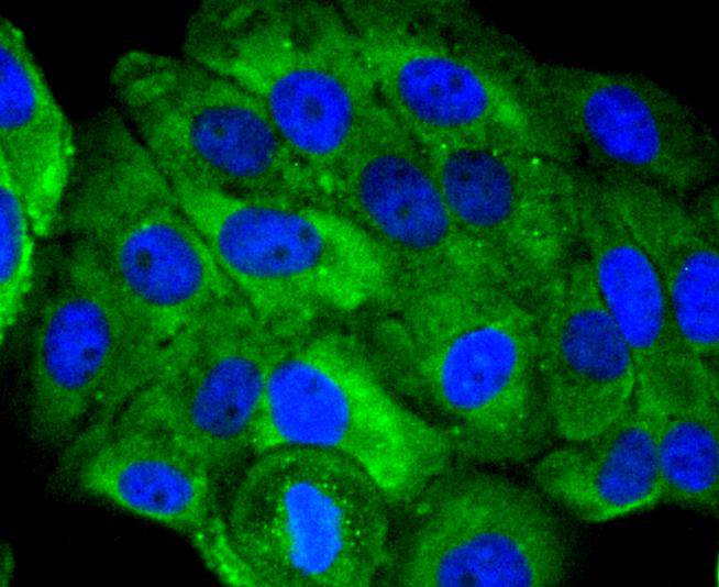 Ubiquitin D Rabbit mAb