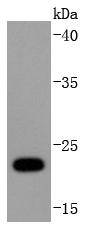 Ubiquitin D Rabbit mAb