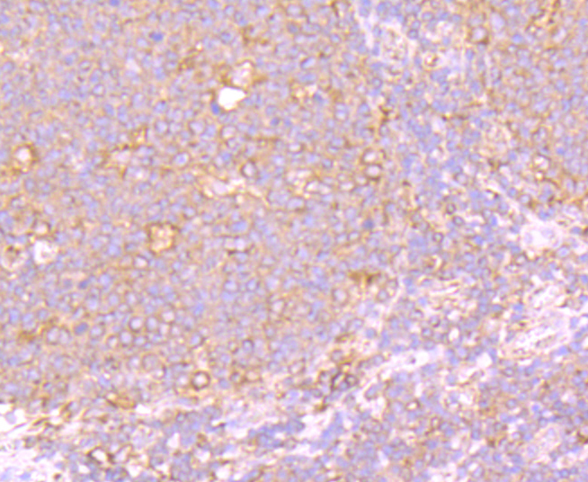 PTP1B Rabbit mAb