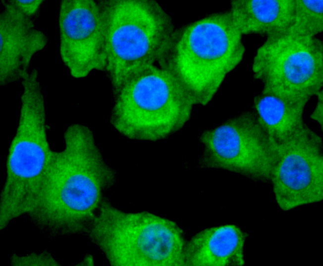 Fatty Acid Synthase Rabbit mAb