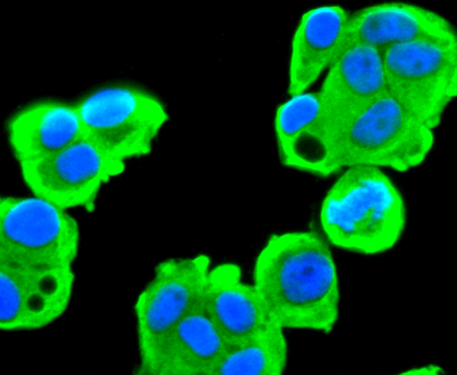 Fatty Acid Synthase Rabbit mAb