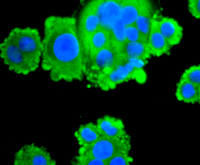 Fatty Acid Synthase Rabbit mAb