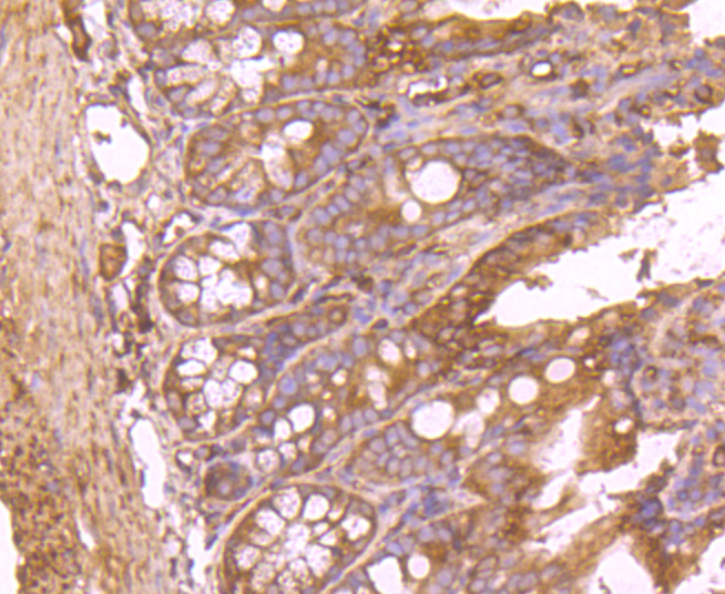 Fatty Acid Synthase Rabbit mAb