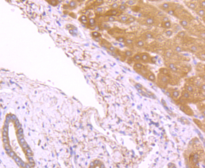 Fatty Acid Synthase Rabbit mAb