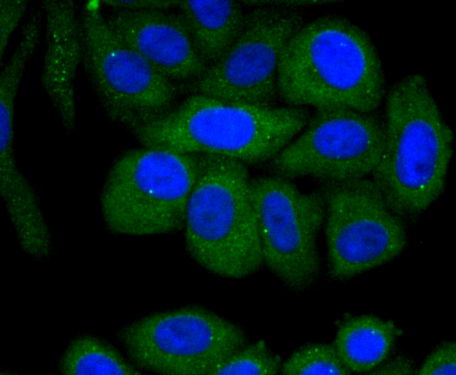 Fas(CD95) Rabbit mAb