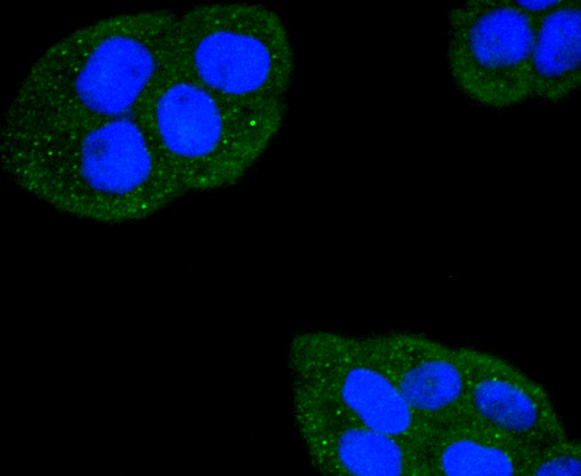 Fas(CD95) Rabbit mAb