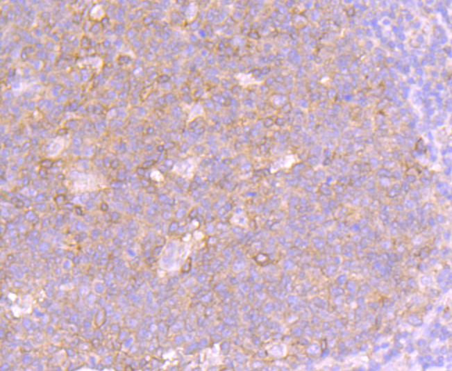 Fas(CD95) Rabbit mAb