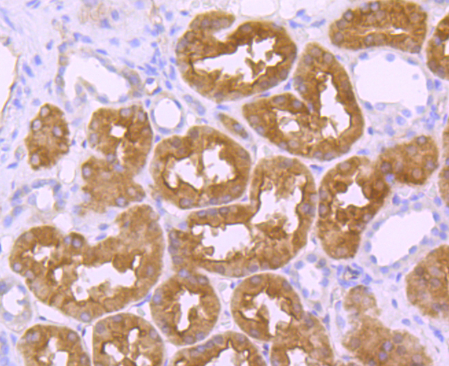 EBP50 Rabbit mAb