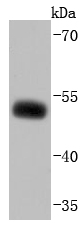 EBP50 Rabbit mAb