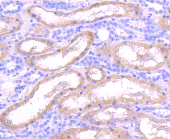 Insulin degrading enzyme Rabbit mAb