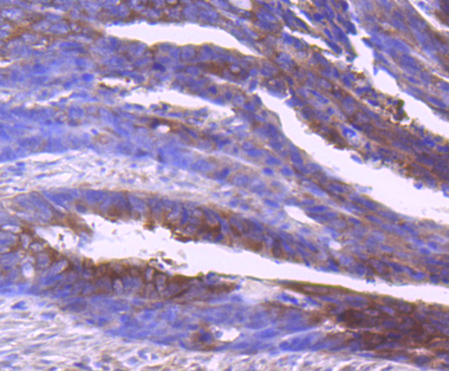 Insulin degrading enzyme Rabbit mAb