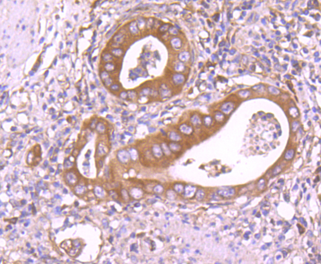 Insulin degrading enzyme Rabbit mAb