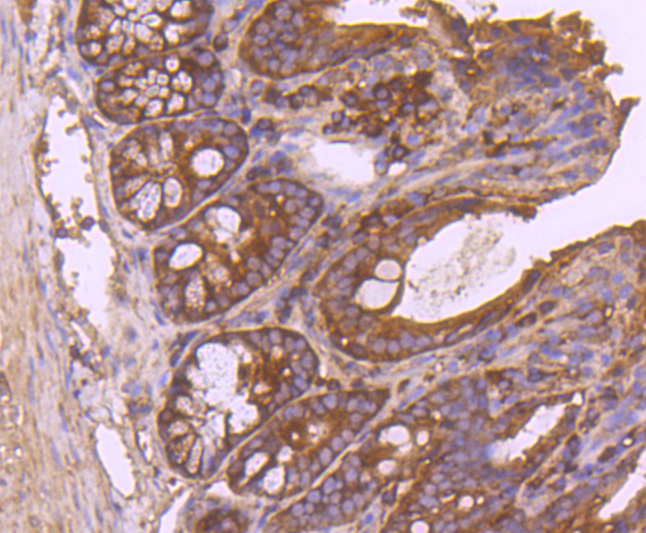 Insulin degrading enzyme Rabbit mAb