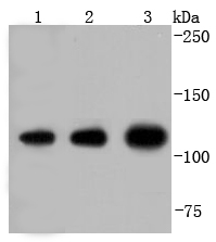 Insulin degrading enzyme Rabbit mAb