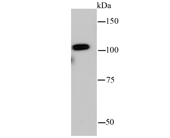 Insulin degrading enzyme Rabbit mAb