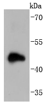 Doublecortin Rabbit mAb