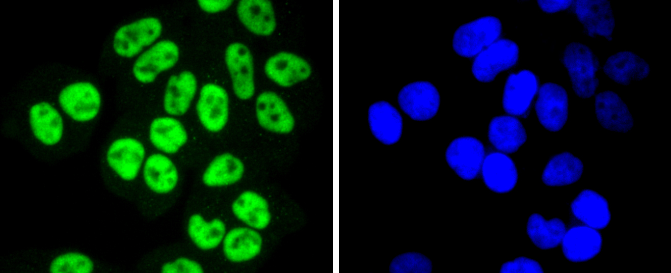 SP1 Rabbit mAb