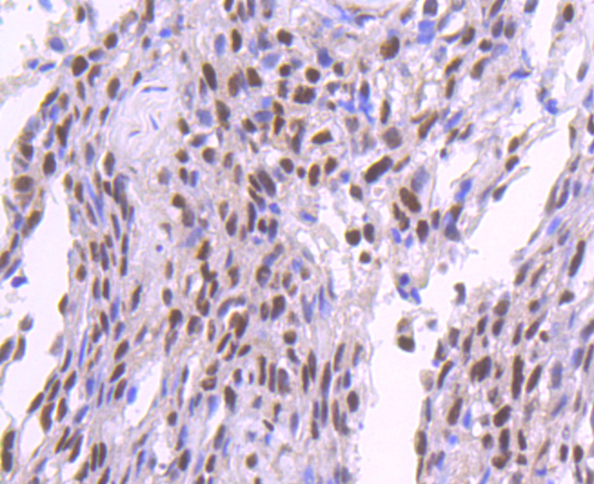 SP1 Rabbit mAb