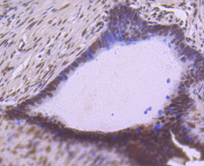 SP1 Rabbit mAb