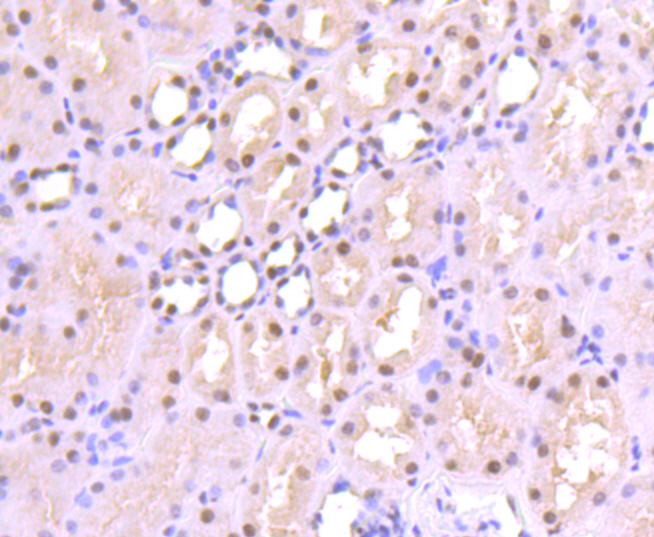 SP1 Rabbit mAb