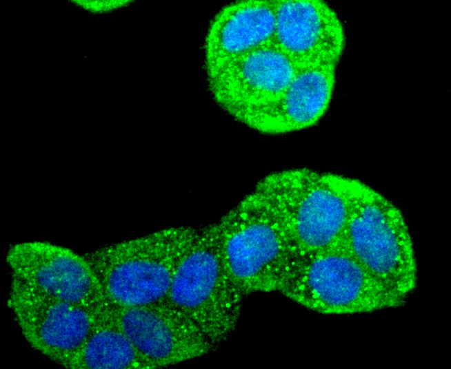 Mannose Receptor(CD206) Rabbit mAb