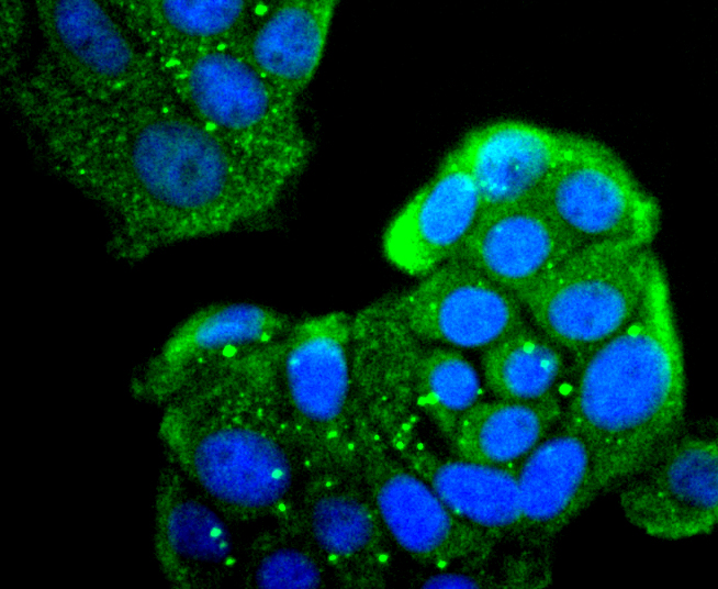 Mannose Receptor(CD206) Rabbit mAb