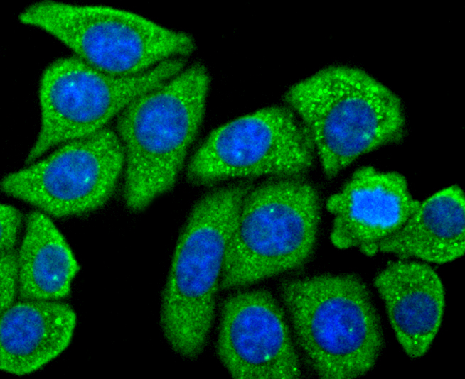 Mannose Receptor(CD206) Rabbit mAb