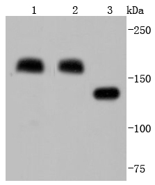 Mannose Receptor(CD206) Rabbit mAb