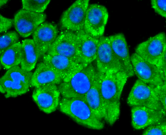 67kDa Laminin Receptor Rabbit mAb