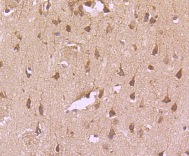 Transferrin Receptor (CD71) Rabbit mAb