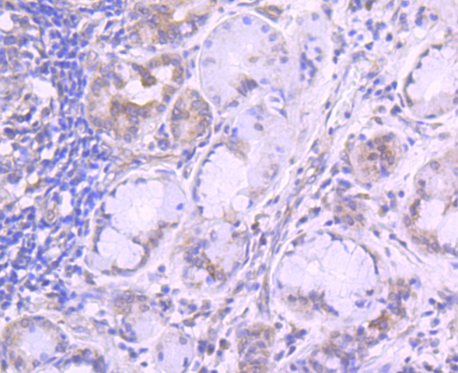 Transferrin Receptor (CD71) Rabbit mAb