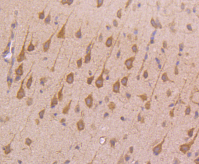 Transferrin Receptor (CD71) Rabbit mAb