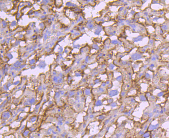 Transferrin Receptor (CD71) Rabbit mAb