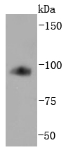 Transferrin Receptor (CD71) Rabbit mAb