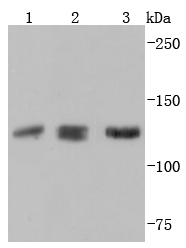 ABL2 Rabbit mAb